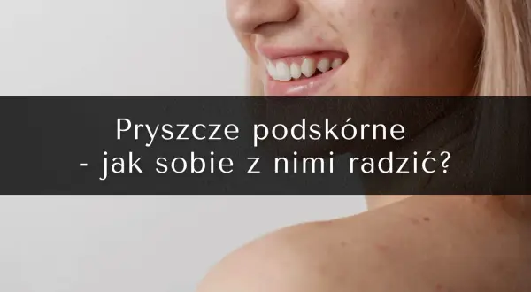 Zbliżenie na twarz i ramię kobiety z widocznymi niedoskonałościami skóry.